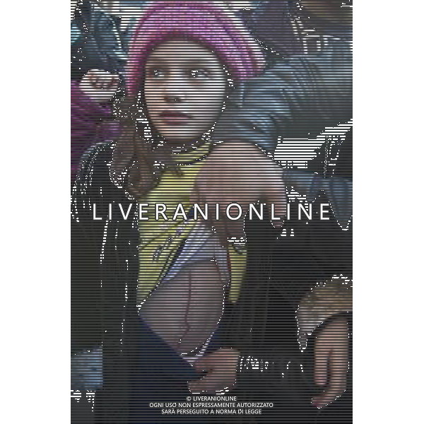 (111229) -- DAMASCUS, Dec. 29, 2011 () -- People show scars on a girl\'s body after she was attacked in Homs, Syria, Dec. 29, 2011. Mohammad Mustafa al-Dabi, the head of Arab League (AL) observer mission, told the private Addounia TV on Wednesday that the situation in Homs is \'placatory till now,\' and has unequivocally confessed the presence of \'gunmen\' in the city. (/Li Muzi) /photoshot/AG ALDO LIVERANI SAS - ITALY ONLY