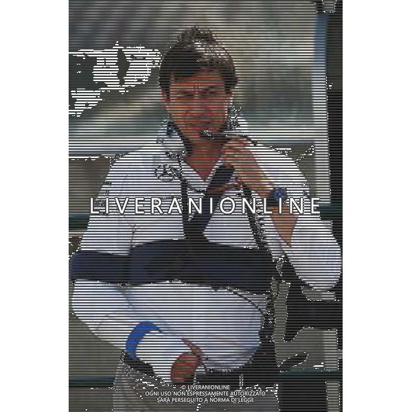 Toto Wolff (GER) Mercedes AMG F1 Shareholder and Executive Director with injuries sustained in a cycling accident. 25.07.2014. Formula 1 World Championship, Rd 11, Hungarian Grand Prix, Budapest, Hungary, Practice Day. - www.xpbimages.com, EMail: requests@xpbimages.com - copy of publication required for printed pictures. Every used picture is fee-liable. © Copyright: Batchelor / XPB Images AG ALDO LIVERANI SAS ONLY ITALY