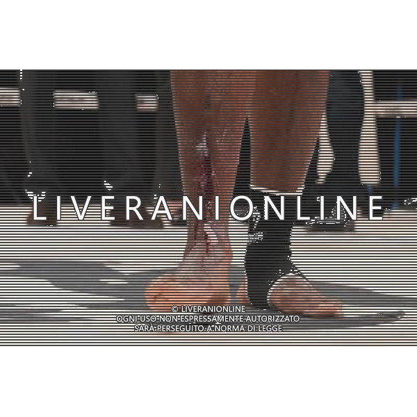 blessure Freddy KEMAYO - 28.11.2015 - Victory World Series - Levallois Photo : Nolwenn Le Gouic / Icon Sport AG ALDO LIVERANI SAS ONLY ITALY