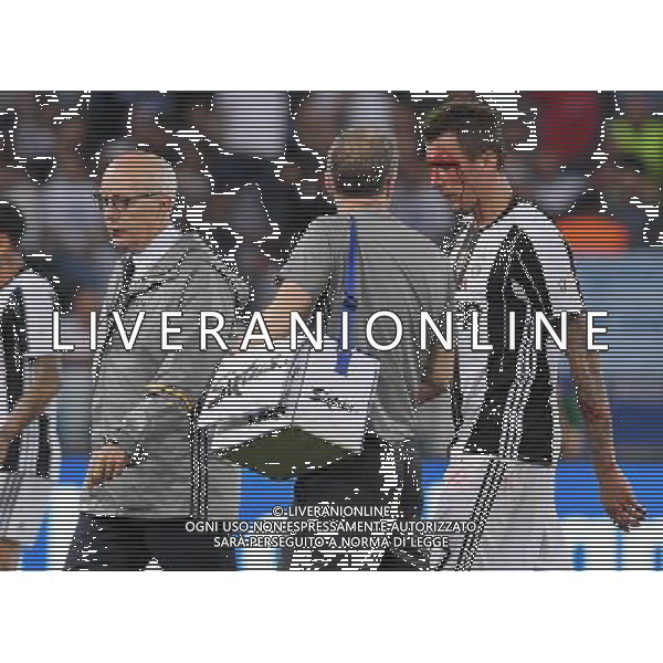 Coppa Italia TIM Cup 2016/2017 Finale Roma - 17.05.2017 Juventus-Lazio Nella Foto: mario mandzukic infortunato al viso /Ph.Vitez-Ag. Aldo Liverani