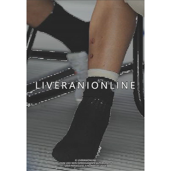 Conferenza Stampa Donadoni Roberto e Cannavaro Fabio Baden - 03.06.2008 Nella Foto:LA CAVIGLIA DI CANNAVARO FABIO CON I SEGNI DEI TACCHETTI DI CHIELLINI /Ph.Vitez-Ag. Aldo Liverani